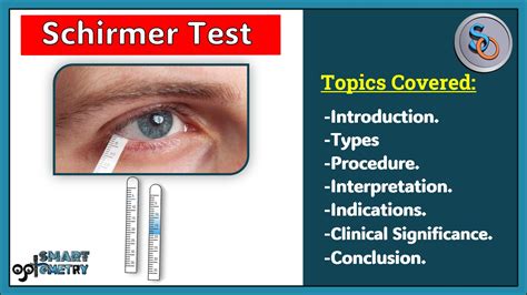 Schirmer test Information 